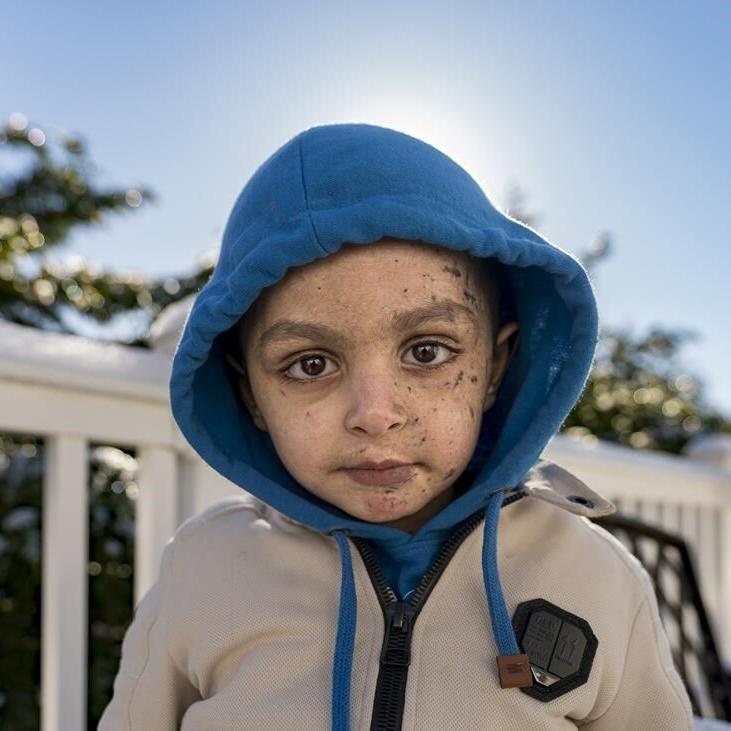 A 4-year-old Gaza boy lost his arm – and his family. Half a world away, he’s getting a second chance